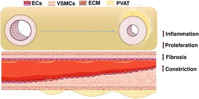 The Molecular Mechanism of Aerobic Exercise Improving Vascular Remodeling in Hypertension